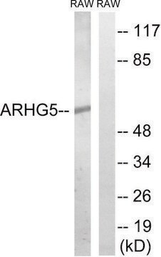 Anti-ARHGEF5 antibody produced in rabbit affinity isolated antibody