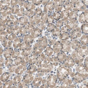 Anti-ZDHHC20 antibody produced in rabbit Prestige Antibodies&#174; Powered by Atlas Antibodies, affinity isolated antibody, buffered aqueous glycerol solution