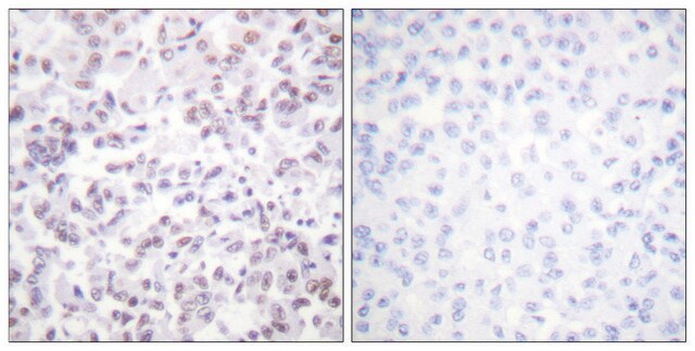 Anti-Histone H2B antibody produced in rabbit affinity isolated antibody