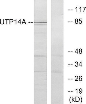 Anti-UTP14A antibody produced in rabbit affinity isolated antibody