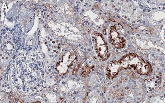 Anti-JAK1 Antibody, clone 1I13 ZooMAb&#174; Rabbit Monoclonal recombinant, expressed in HEK 293 cells