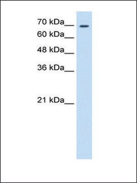 Anti-TGM2 (AB2) antibody produced in rabbit affinity isolated antibody