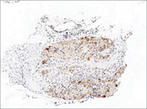 抗-TRPA1 兔抗 affinity isolated antibody