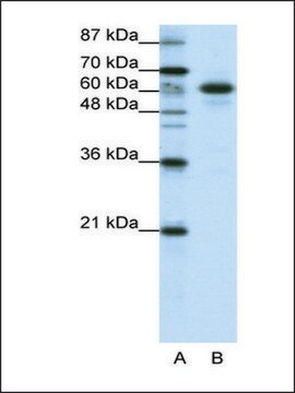 Anti-CBLL1 antibody produced in rabbit IgG fraction of antiserum