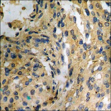 Anti-phospho-CBL (pTyr700) antibody produced in rabbit affinity isolated antibody