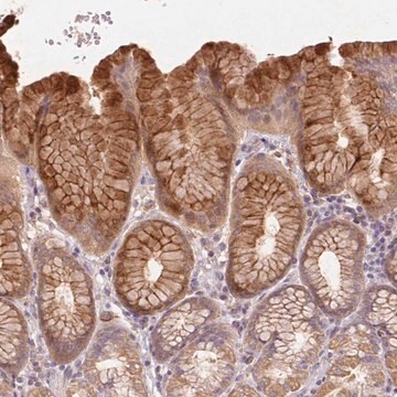 Anti-REP15 antibody produced in rabbit Prestige Antibodies&#174; Powered by Atlas Antibodies, affinity isolated antibody, buffered aqueous glycerol solution