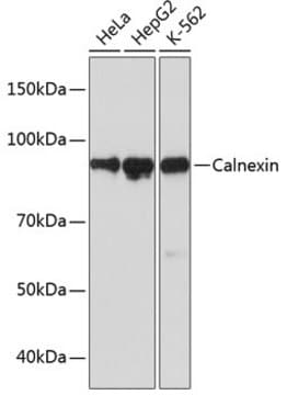 Anti-Calnexin Antibody, clone 5S3U3, Rabbit Monoclonal