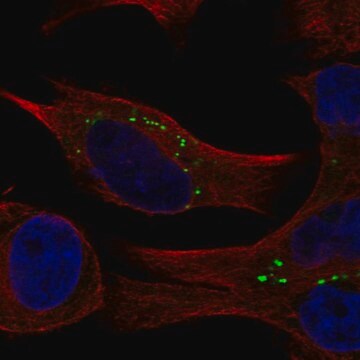 Anti-Commd2 Antibody Produced In Rabbit Prestige Antibodies&#174; Powered by Atlas Antibodies, affinity isolated antibody, buffered aqueous glycerol solution