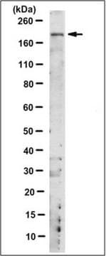 Anti-CRB1 Antibody, clone 1C2.1 clone 1C2.1, from mouse