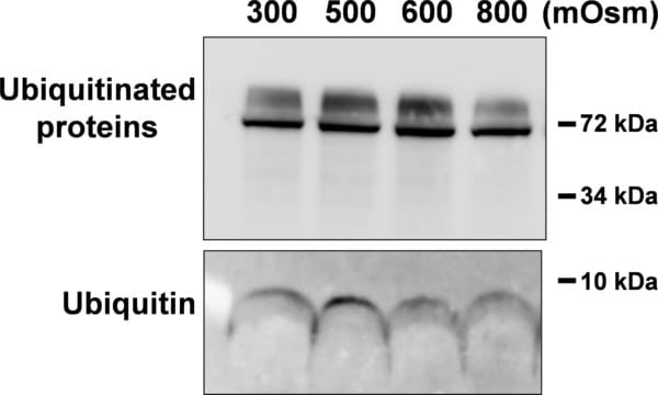 Anticorpo anti-ubiquitina, clone P4D1-A11 clone P4D1-A11, Upstate&#174;, from mouse