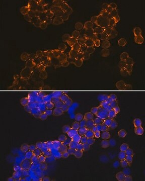 Anti-NMDAR1 antibody produced in rabbit