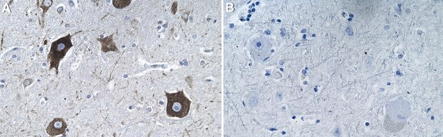 Anti-eIF4G1 Antibody, clone 2C6 ZooMAb&#174; Rabbit Monoclonal recombinant, expressed in HEK 293 cells