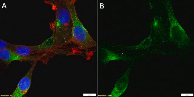 Anti-GPR158 Antibody, clone 2D19 ZooMAb&#174; Rabbit Monoclonal recombinant, expressed in HEK 293 cells