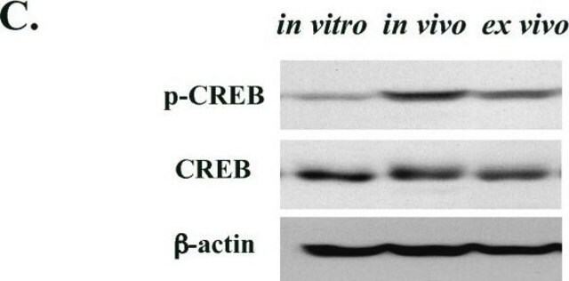 Anticuerpo anti-fosfo-CREB (Ser133) Upstate&#174;, from rabbit