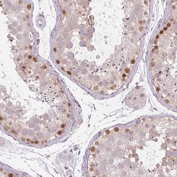 Anti-CHTF8 antibody produced in rabbit Prestige Antibodies&#174; Powered by Atlas Antibodies, affinity isolated antibody, buffered aqueous glycerol solution