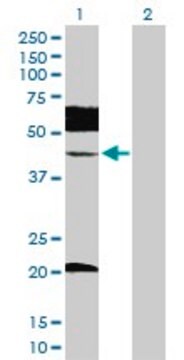 Anti-UBE2Q2 antibody produced in rabbit purified immunoglobulin, buffered aqueous solution