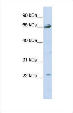 Anti-P2RX2 (ab4) antibody produced in rabbit affinity isolated antibody