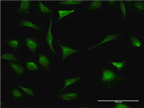 Monoclonal Anti-XBP1 antibody produced in mouse clone 3F5, purified immunoglobulin, buffered aqueous solution