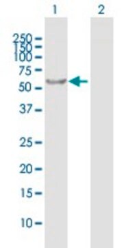 Anti-RABGGTA antibody produced in mouse purified immunoglobulin, buffered aqueous solution