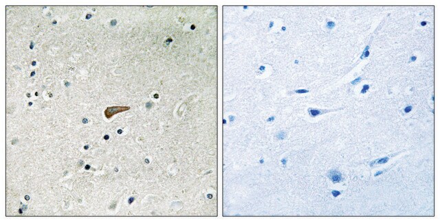 Anti-phospho-FRS2 (pTyr436) antibody produced in rabbit affinity isolated antibody