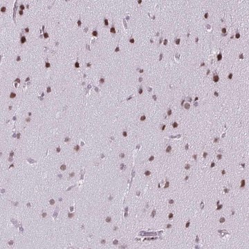 Anti-SS18 antibody produced in rabbit Prestige Antibodies&#174; Powered by Atlas Antibodies, affinity isolated antibody, buffered aqueous glycerol solution