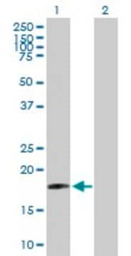 Anti-SIVA antibody produced in mouse purified immunoglobulin, buffered aqueous solution