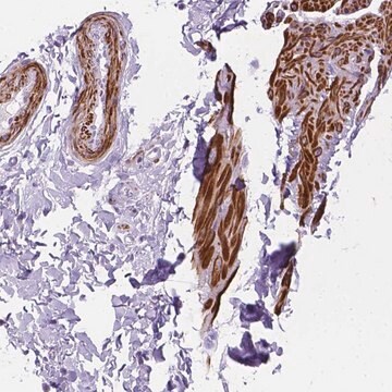 Anti-HHIPL1 antibody produced in rabbit Prestige Antibodies&#174; Powered by Atlas Antibodies, affinity isolated antibody, buffered aqueous glycerol solution