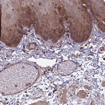 Anti-C15orf62 antibody produced in rabbit Prestige Antibodies&#174; Powered by Atlas Antibodies, affinity isolated antibody, buffered aqueous glycerol solution