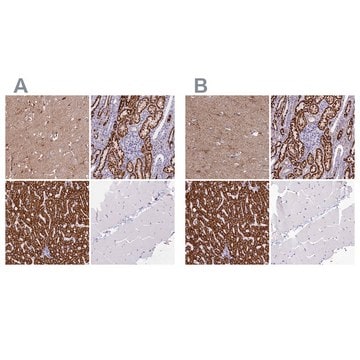 Anti-ABAT antibody produced in rabbit Prestige Antibodies&#174; Powered by Atlas Antibodies, affinity isolated antibody, buffered aqueous glycerol solution