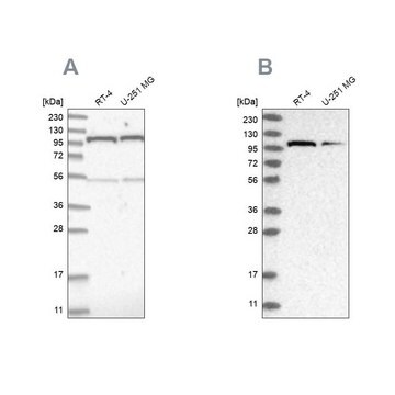 Anti-OGT antibody produced in rabbit Prestige Antibodies&#174; Powered by Atlas Antibodies, affinity isolated antibody