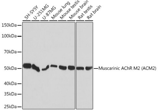 Anti-Muscarinic AChR M2 (ACM2) Antibody, clone 3T5W8, Rabbit Monoclonal