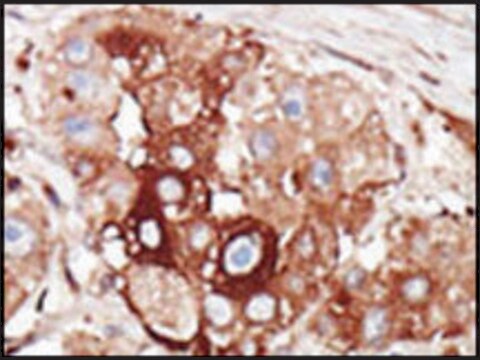 Anti-TRRAP (center) antibody produced in rabbit IgG fraction of antiserum, buffered aqueous solution