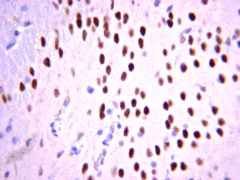 Anti-Tbr1 Antibody from chicken, purified by affinity chromatography