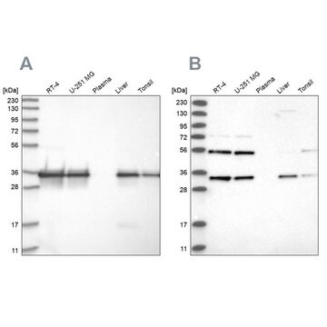 Anti-PPA2 antibody produced in rabbit Prestige Antibodies&#174; Powered by Atlas Antibodies, affinity isolated antibody, buffered aqueous glycerol solution