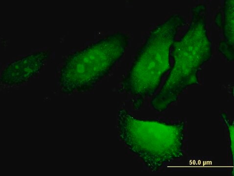 Monoclonal Anti-RERG antibody produced in mouse clone 1C5, purified immunoglobulin, buffered aqueous solution