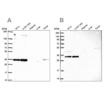 Anti-NOSIP antibody produced in rabbit Prestige Antibodies&#174; Powered by Atlas Antibodies, affinity isolated antibody