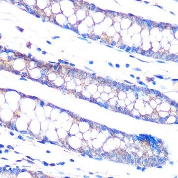 Anti-DUSP6 antibody produced in rabbit