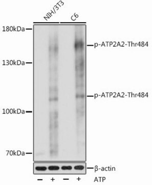 Anti-Phospho-ATP2A2-Thr484 antibody produced in rabbit