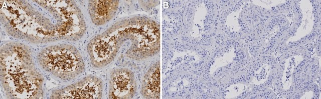 Anti-GPx4 Antibody, clone 1G5 ZooMAb&#174; Rabbit Monoclonal recombinant, expressed in HEK 293 cells