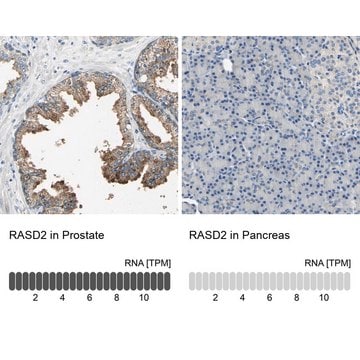 Anti-RASD2 antibody produced in rabbit Prestige Antibodies&#174; Powered by Atlas Antibodies, affinity isolated antibody, buffered aqueous glycerol solution