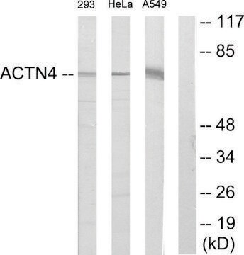 Anti-ACTN1 antibody produced in rabbit affinity isolated antibody