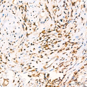 Anti-GRB2 Antibody, clone 9K6H0, Rabbit Monoclonal