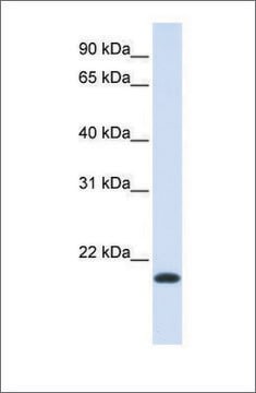 Anti-NKAIN1 antibody produced in rabbit affinity isolated antibody