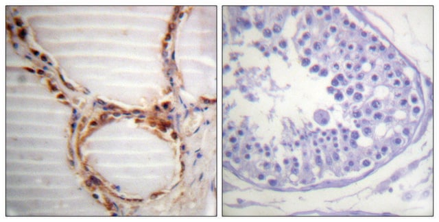 Anti-MCM4 antibody produced in rabbit affinity isolated antibody