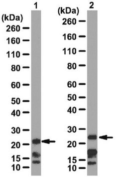 Anti-Cbx7-Antikörper from rabbit, purified by affinity chromatography