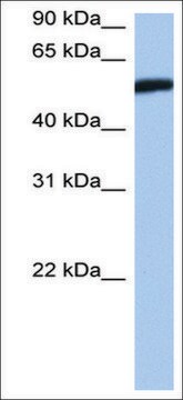 Anti-HMG20A (AB2) antibody produced in rabbit affinity isolated antibody