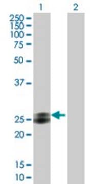 Anti-EPDR1 antibody produced in mouse purified immunoglobulin, buffered aqueous solution