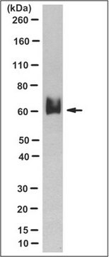 Anti-Tip60, clone 1E6.6 Antibody clone 1E6.6, from mouse | Sigma-Aldrich