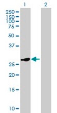 Anti-HSD17B8 antibody produced in mouse IgG fraction of antiserum, buffered aqueous solution