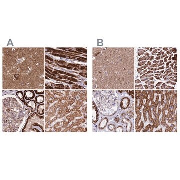 Anti-ATP5H antibody produced in rabbit Prestige Antibodies&#174; Powered by Atlas Antibodies, affinity isolated antibody, buffered aqueous glycerol solution